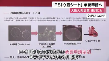 「ｉＰＳ心筋シート」来月にも承認申請へ　大阪大学発の企業