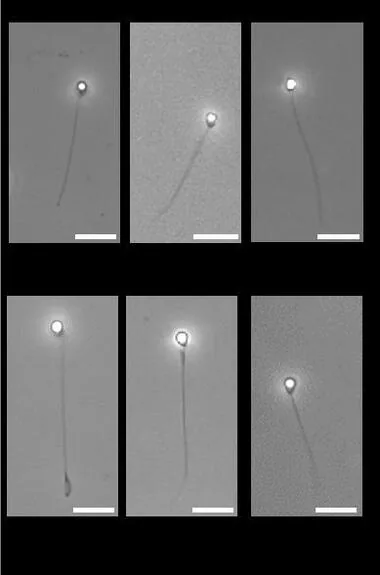 頭でっかちな“精子” は卵子に入れない？ 北海道大学が研究発表 魚の実験で精子の頭部サイズが受精成功に影響することを発見